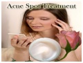 Acne treatments 4564.jpg